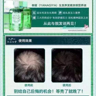 產后脫發怎么辦？這些方法幫你減少掉發，拒絕禿頂危機